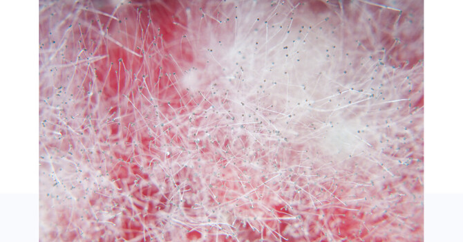 Fungus and Mycotoxins